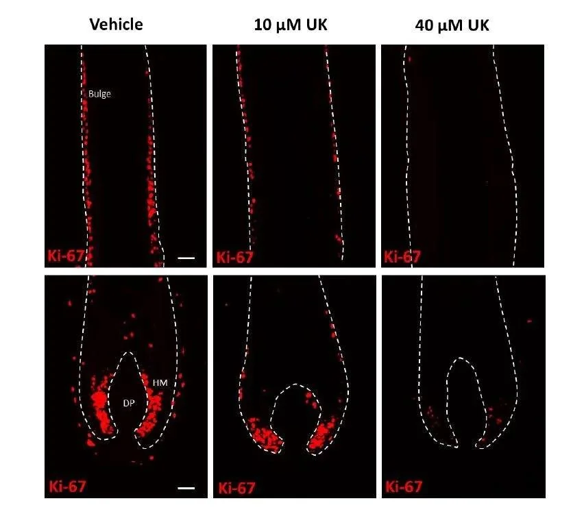 Reduced proliferation of matrix and outer root sheath cells in human hair follicles exposed to UK-5099 ex vivo