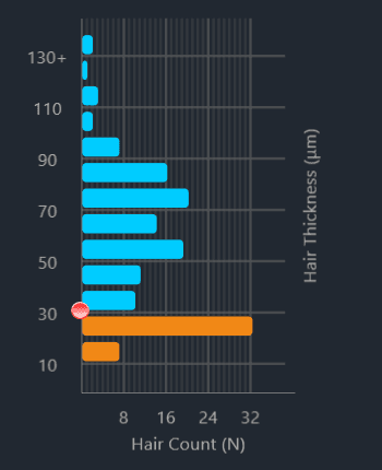 A histogram of hair thickness in microns against hair count, with terminal hairs in blue and vellus hairs in orange.