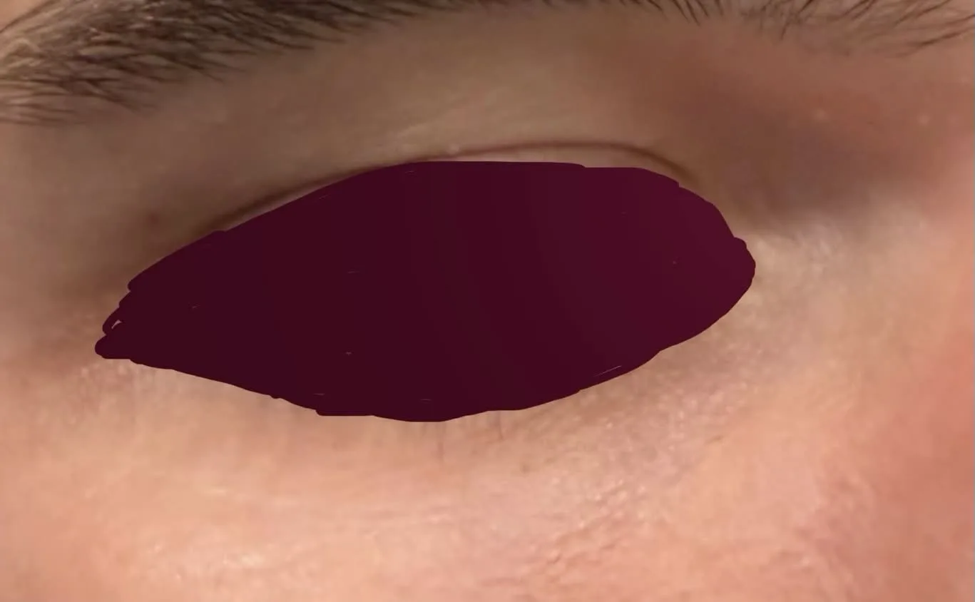 bobthebooler's under-eye area after switching to MINX