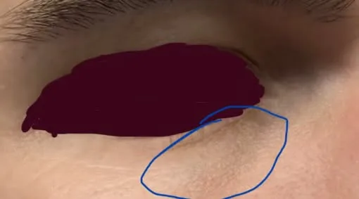 bobthebooler's under-eye area before switching to MINX