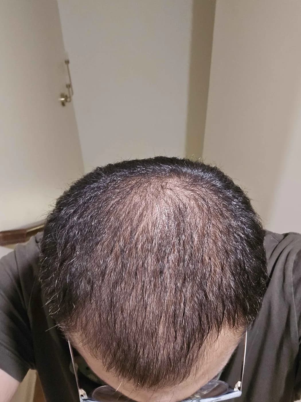 darkprinx2500's crown in July